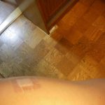 コロナワクチン